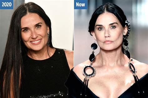 Demi Moore, 58, sparks plastic surgery rumours with 